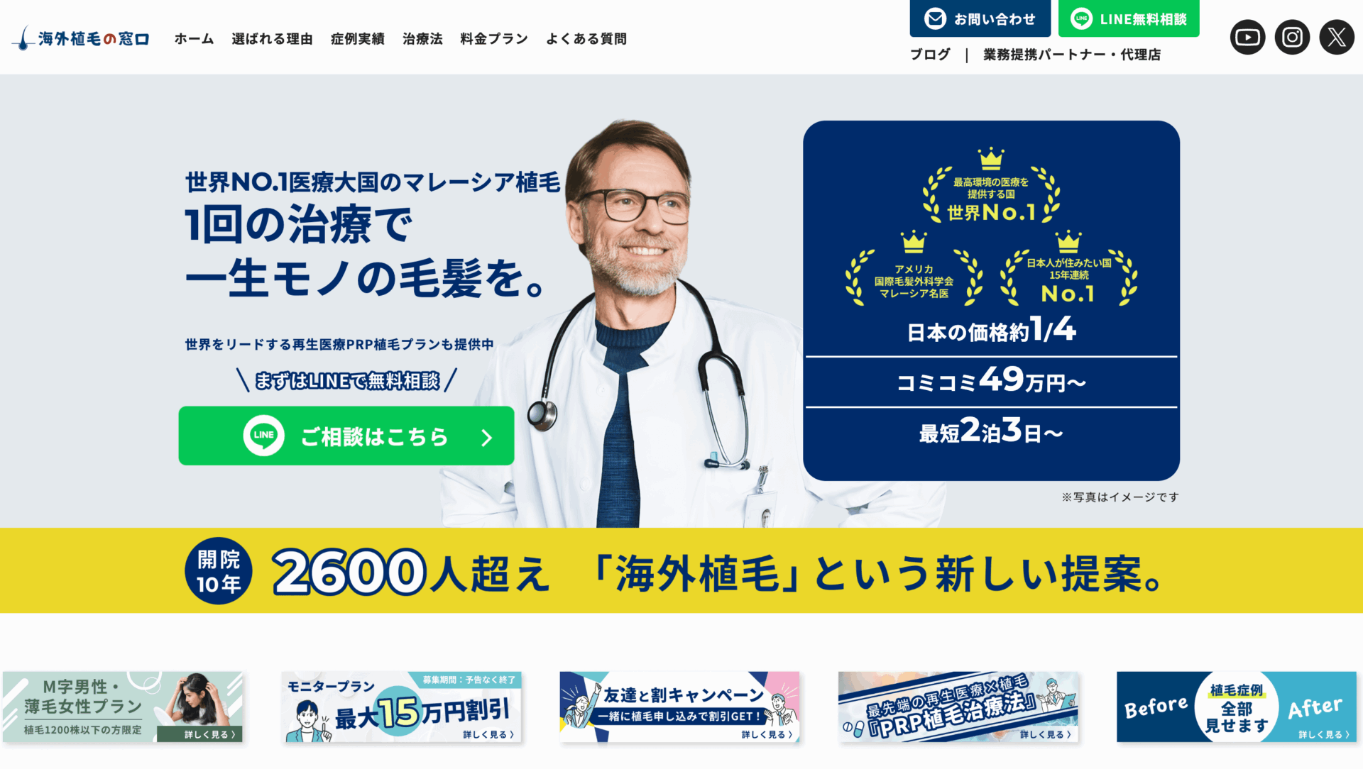 ちょこっとプラン