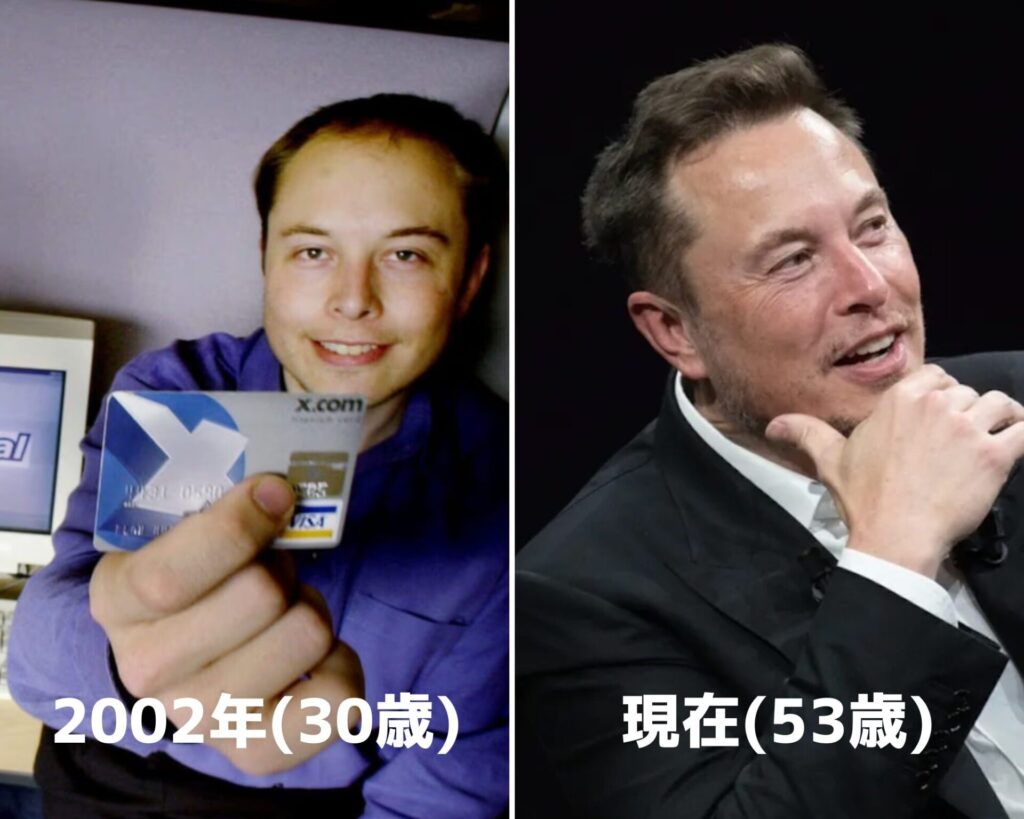 イーロン・マスクは植毛なの？噂の真相と最新植毛事情を徹底解説 |  海外植毛の窓口®｜医療大国マレーシア自毛植毛海外植毛の窓口®｜医療大国マレーシア自毛植毛