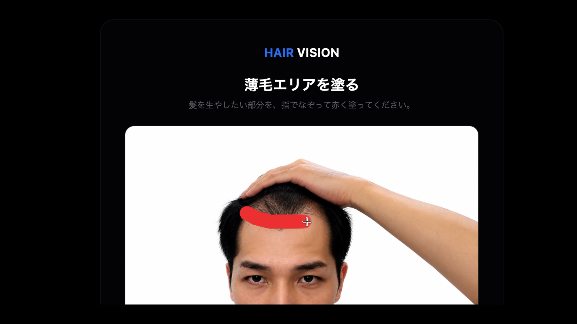 HAIR VISION 薄毛エリアを塗る画面